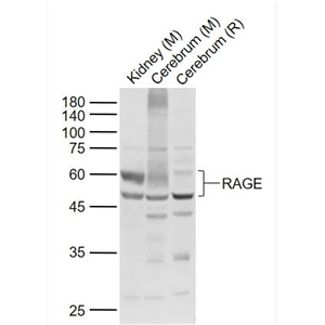 Anti-RAGE antibody-晚期糖基化终末产物特异性受体抗体