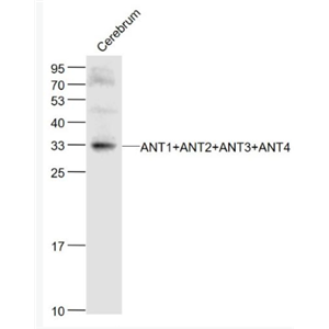 Anti-ANT1+ANT2+ANT3+ANT4 antibody-腺嘌呤核苷酸转运蛋白1、2、3、4抗体