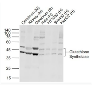 Anti-Glutathione Synthetase antibody-谷胱甘肽合成酶抗体