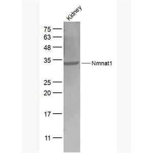 Anti-Nmnat1 antibody-烟酰胺核苷酸腺苷转移酶1抗体,Nmnat1