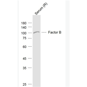 Anti-Factor B antibody-补体因子B抗体,Factor B