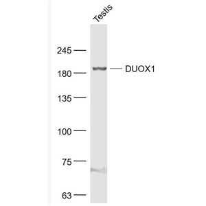 Anti-DUOX1 antibody-双氧化酶1/甲状腺氧化酶1抗体