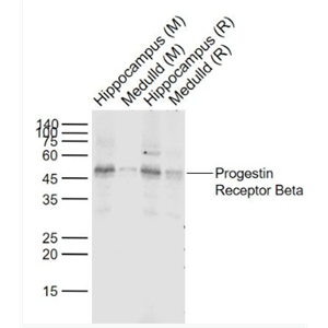 Anti-Progestin Receptor Beta antibody-孕激素受体β（MPRβ）抗体