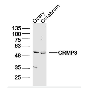 Anti-CRMP3 antibody-二氢嘧啶酶相关蛋白3抗体,CRMP3