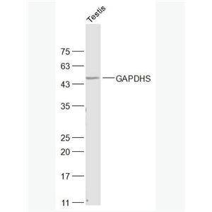 Anti-GAPDHS antibody-精子3-磷酸甘油醛脱氢酶-2抗体