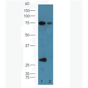 Anti-Factor D antibody-补体因子D抗体