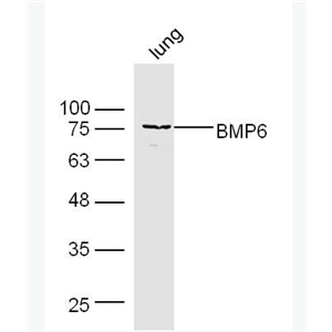 Anti-BMP6 antibody-骨形态发生蛋白6抗体