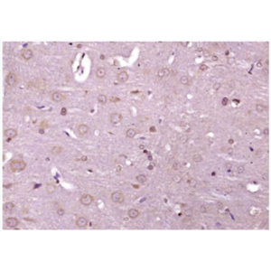 Anti-phospho-IRE1a (Ser 726) antibody-磷酸化内质网核信号转导蛋白a1抗体