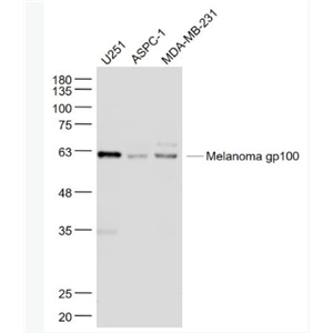 Anti-Melanoma gp100 antibody-黑色素瘤相关抗原gp100抗体