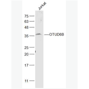 Anti-OTUD6B antibody-OTUD6B蛋白抗体