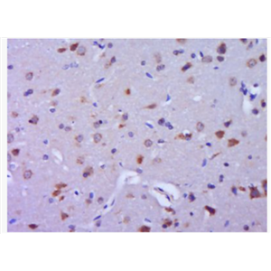 Anti-TRIM9 antibody-TRIM9蛋白抗體,TRIM9