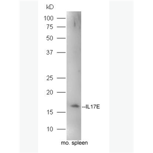 Anti-IL17E antibody-白介素-17E抗体