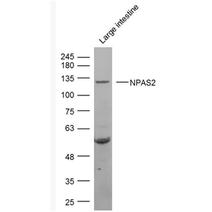 Anti-NPAS2 antibody-神经细胞PAS结构域蛋白2抗体,NPAS2