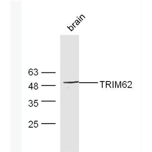 Anti-TRIM62 antibody-TRIM62蛋白抗体