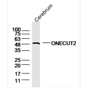 Anti-ONECUT2 antibody-转录因子ONECUT2抗体