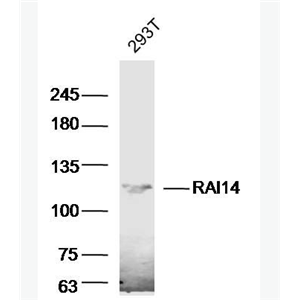 Anti-RAI14 antibody-维甲酸诱导蛋白14抗体,RAI14