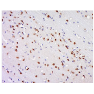 Anti-TNFAIP8L3 antibody-肿瘤坏死因子诱导蛋白8样蛋白3/TNFα-IP 8L3抗体