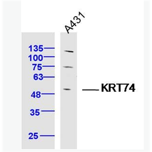 Anti-KRT74  antibody-细胞角蛋白74抗体