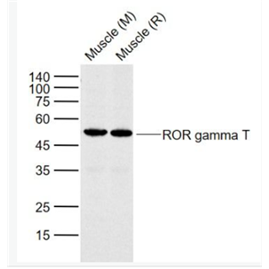 Anti-ROR gamma T antibody-维甲酸相关孤儿受体γt抗体,ROR gamma T