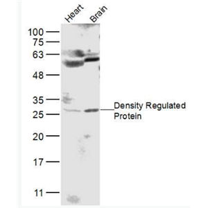 Anti-Density Regulated Protein antibody-密度调节蛋白抗体,Density Regulated Protein