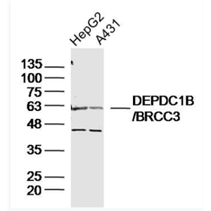 Anti-DEPDC1B/BRCC3 antibody-乳腺癌细胞3抗体