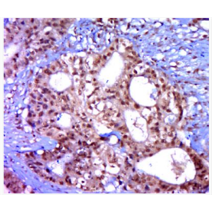 Anti-phospho-eIF2B epsilon (Ser539) antibody-磷酸化eIF2B蛋白抗體,phospho-eIF2B epsilon (Ser539)