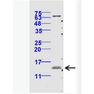 Anti-phospho-eIF4EBP1（Thr70） antibody-磷酸化eIF4E结合蛋白抗体