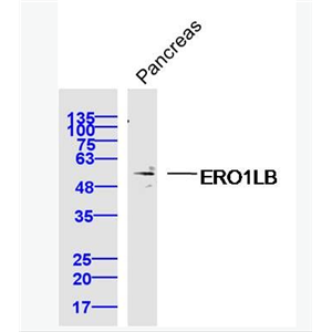 Anti-ERO1LB antibody-Ero1-Lβ蛋白抗体,ERO1LB