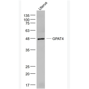 Anti-GPAT4 antibody-甘油-3-磷酸酰基转移酶4抗体
