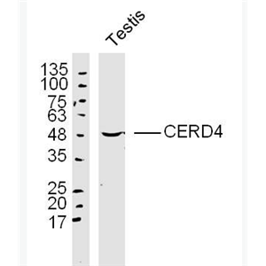 Anti-CERD4 antibody-CERD4蛋白抗体