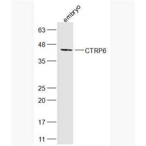 Anti-CTRP6 antibody-补体C1q肿瘤坏死因子相关蛋白6抗体