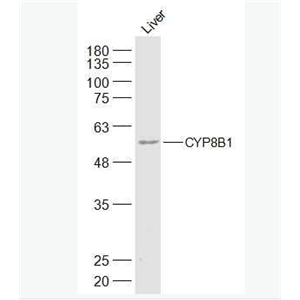 Anti-CYP8B1 antibody-细胞色素P450 8B1抗体