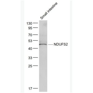 Anti-NDUFS2 antibody-NDUFS2抗体