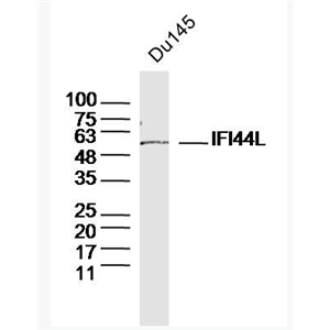 Anti-IFI44L antibody-干扰素诱导蛋白44样蛋白抗体