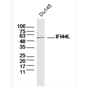 Anti-IFI44L antibody-干扰素诱导蛋白44样蛋白抗体,IFI44L