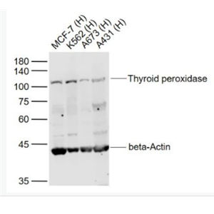 Anti-Thyroid peroxidase antibody-甲状腺过氧化物酶抗体