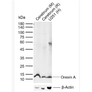 Anti-Orexin A antibody-增食欲素A/欲激素A抗体