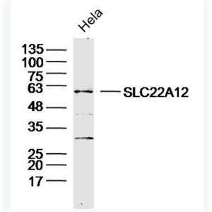 Anti-SLC22A12 antibody-尿酸盐重吸收转运子1抗体