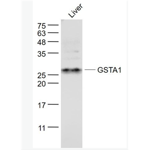 Anti-GSTA1  antibody-谷胱甘肽S转移酶α1抗体