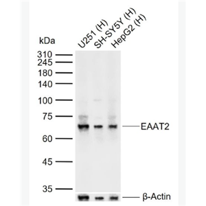Anti-EAAT2 antibody-胶质细胞谷氨酸运载蛋白2抗体