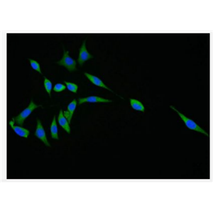 Anti-Smac antibody-线粒体促凋亡蛋白抗体