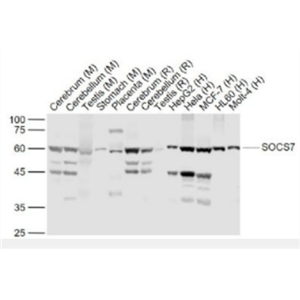 Anti-SOCS7 antibody-信号转导和转录激活因子7抗体,SOCS7