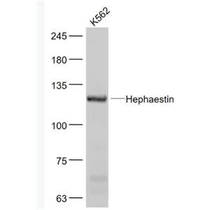 Anti-Hephaestin antibody-亚铁氧化酶抗体
