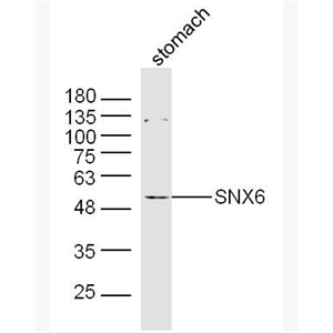 Anti-SNX6 antibody-分选连接蛋白6抗体