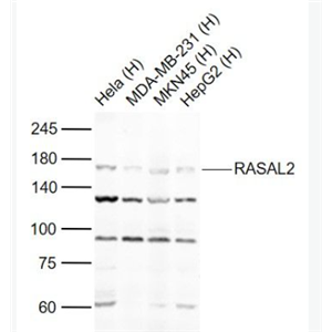 Anti-RASAL2 antibody-RASAL2蛋白抗体
