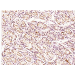 Anti-CCL27 antibody-皮肤T细胞虏获趋化因子抗体