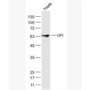 Anti-GPI antibody-糖磷脂酰肌醇抗体