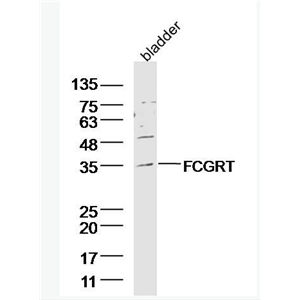 Anti-FCGRT antibody-IgG-Fc片断受体转运蛋白α抗体,FCGRT