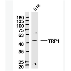 Anti-TYRP1 antibody-酪氨酸酶相关蛋白1抗体