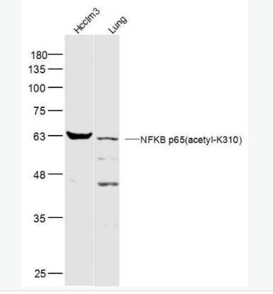Anti-NFKB p65(acetyl K310) antibody-乙酰化细胞核因子NFKBp65抗体,NFKB p65(acetyl K310)